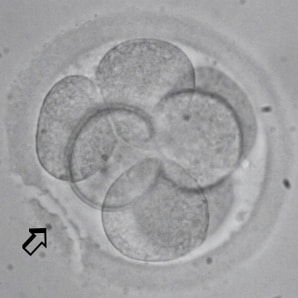 Hatching assistito